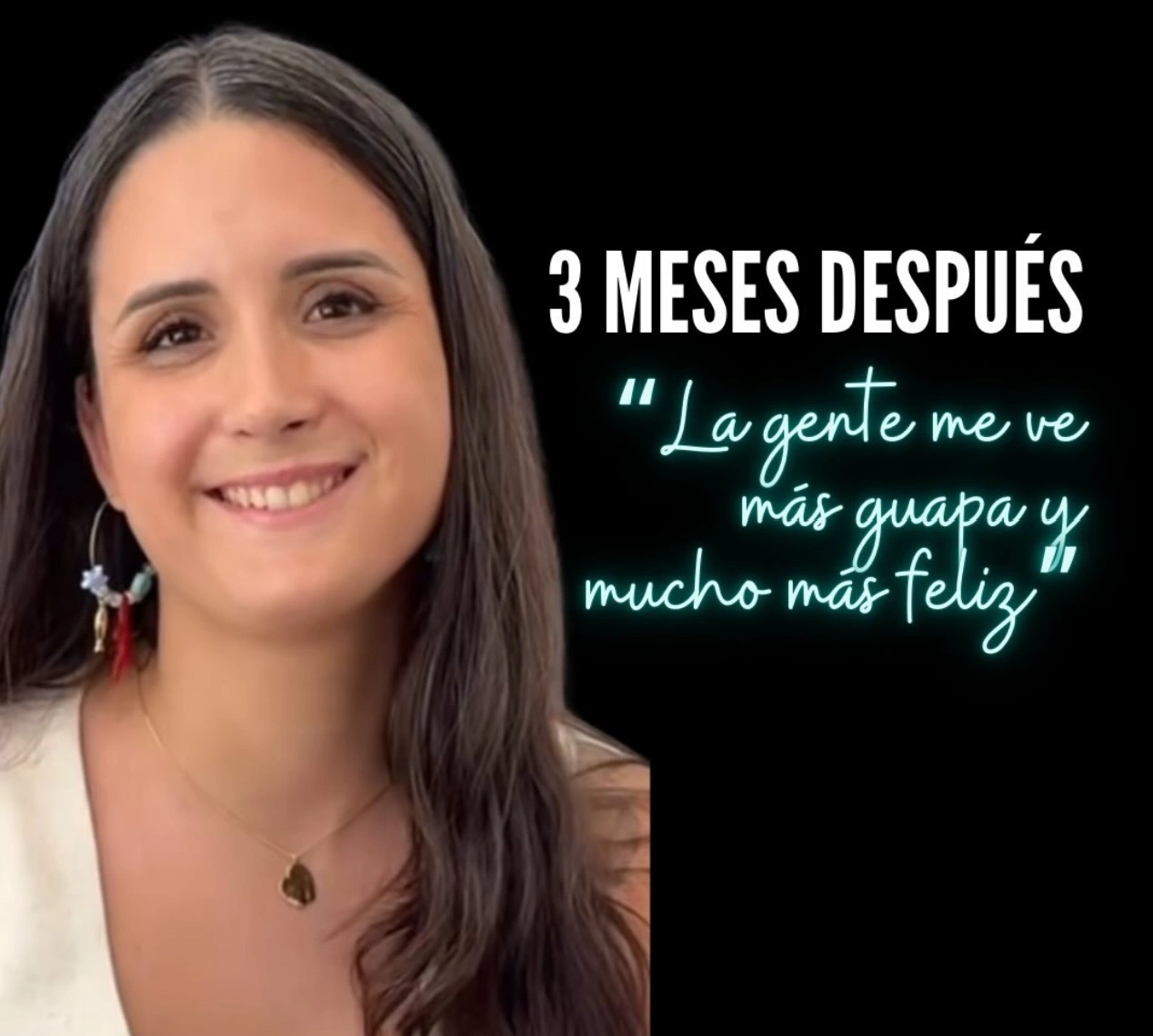 Consideraciones psicológicas y emocionales de rinoplastia