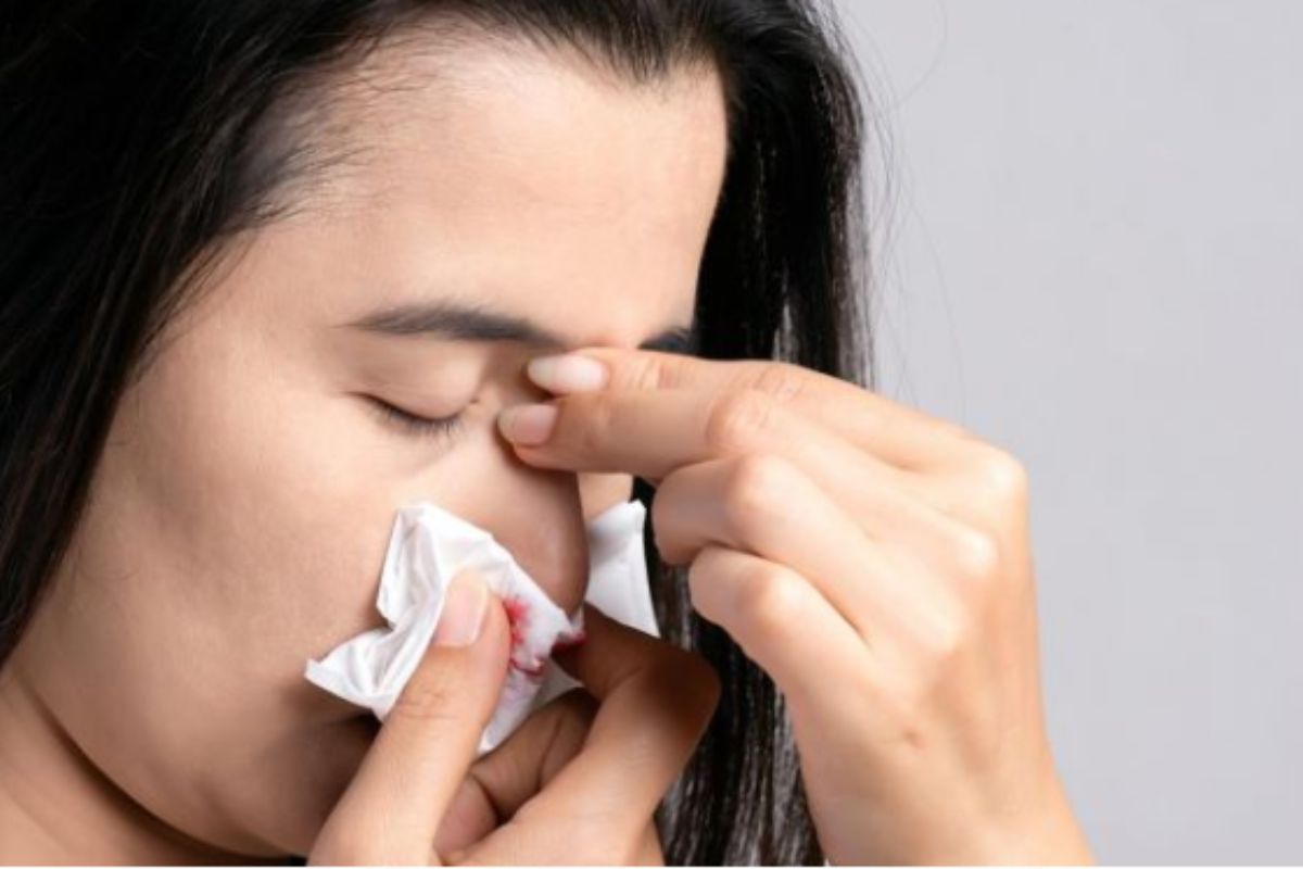 Hemorragia nasal frecuente