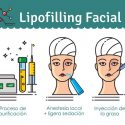 Pasos necesarios para un lipofilling facial