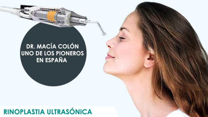 Rinoplastia ultrasonica en Madrid por el Dr. Macía Colón